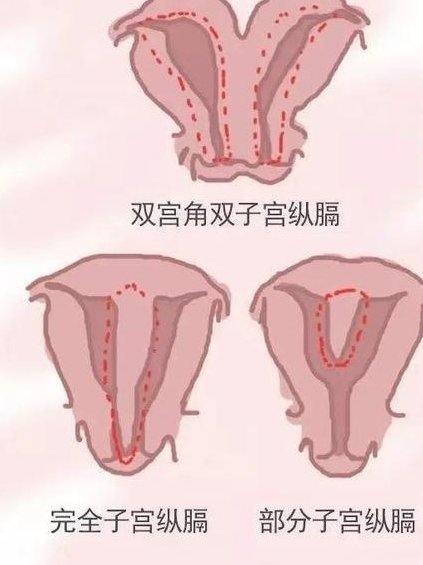 上海三代试管生孩子多少钱？9万块能做三代吗？